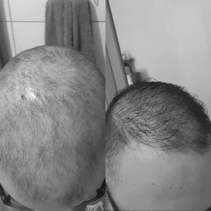 Blend Capilar - Tônico pró Crescimento + Shampoo Antiqueda - Barba de Respeito