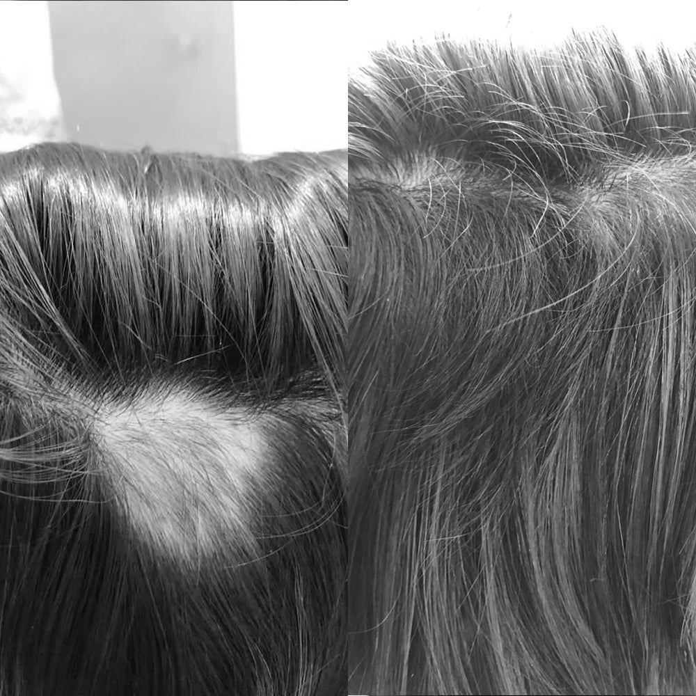 Blend Capilar - Tônico Pró Crescimento + Shampoo Antiqueda 2 Meses - Barba de Respeito