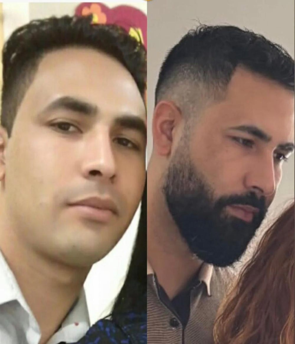 Imagem de antes e depois