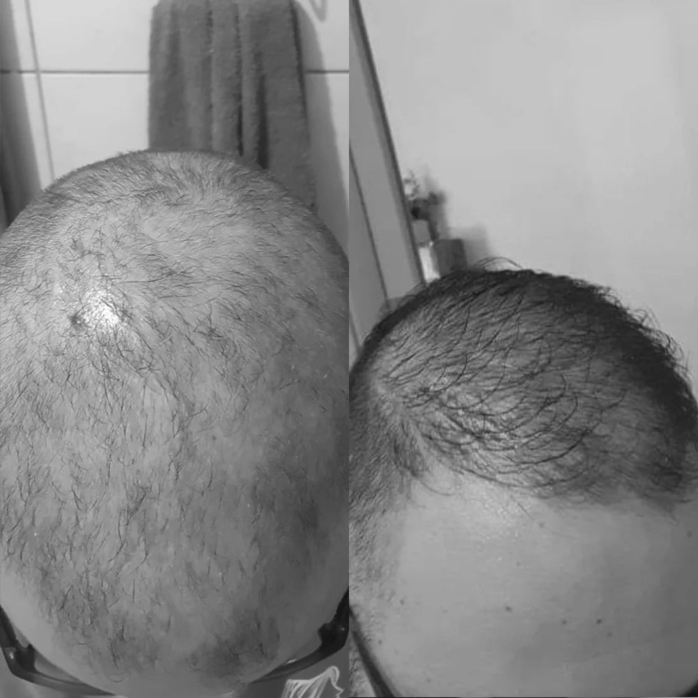 Imagem de antes e depois