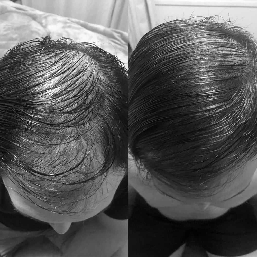 Imagem de antes e depois