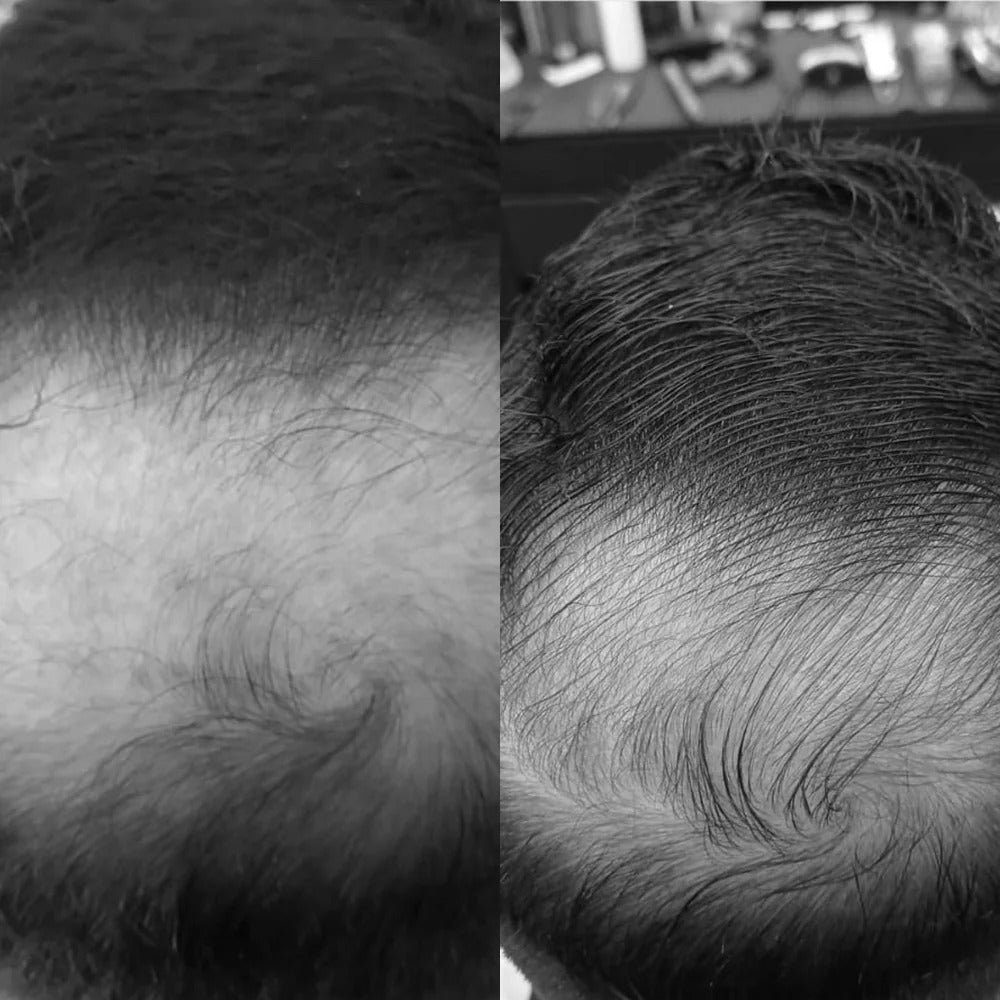 Imagem de antes e depois