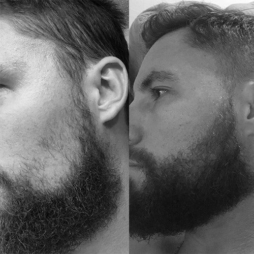 Imagem de antes e depois