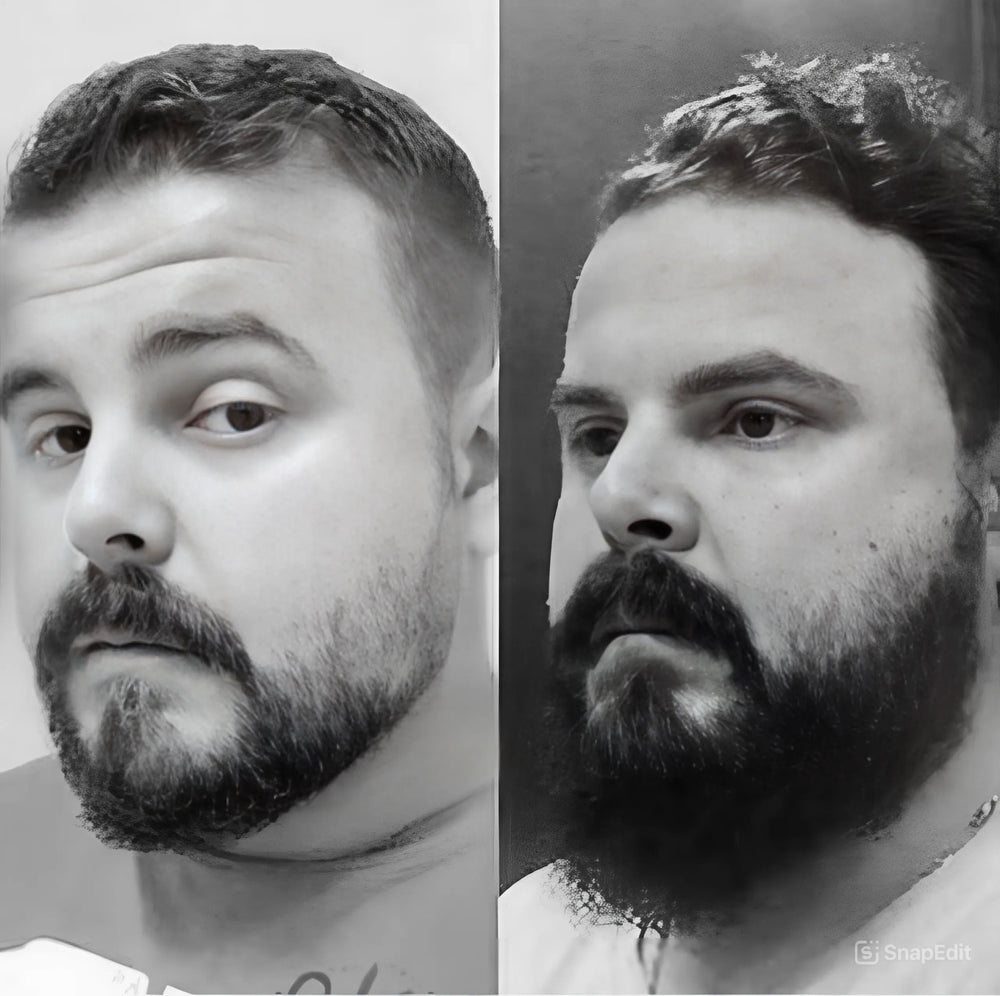 Imagem de antes e depois