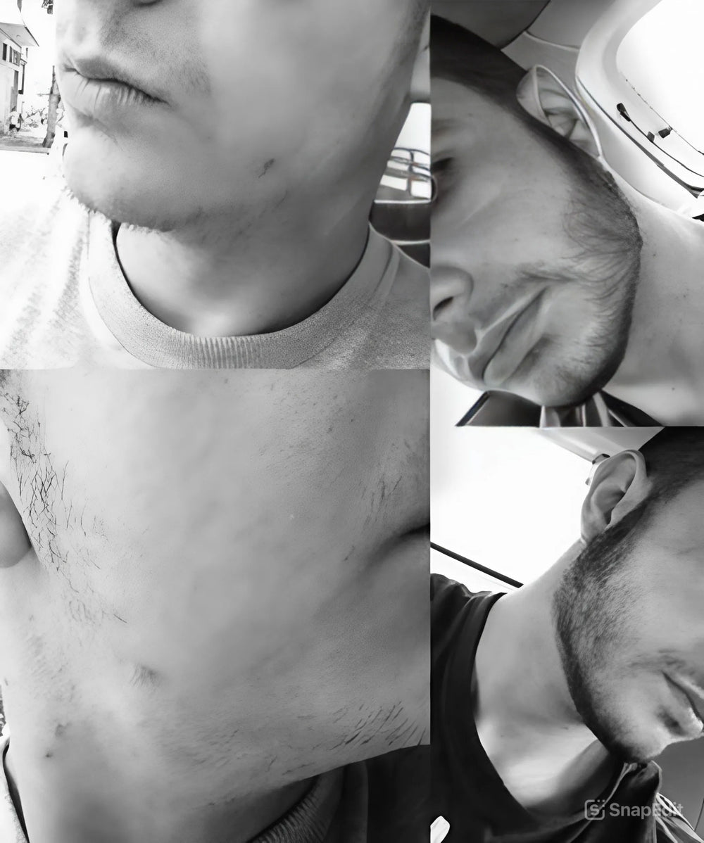 Imagem de antes e depois