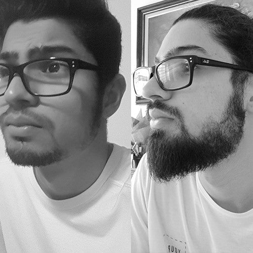 Imagem de antes e depois